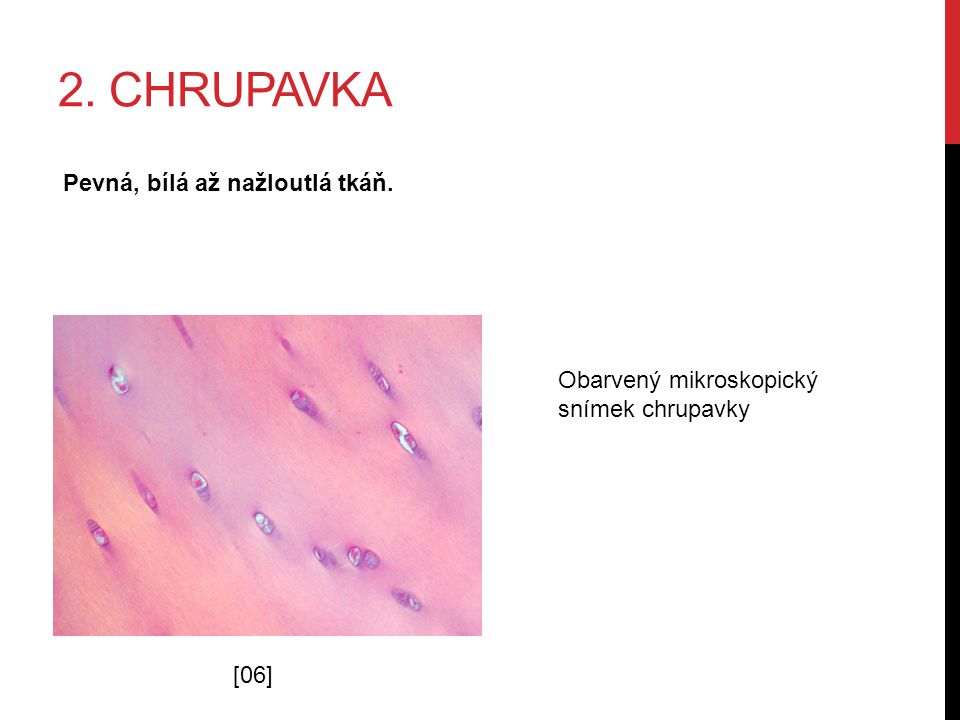 2. CHRUPAVKA Pevná, bílá až nažloutlá tkáň. [06] Obarvený mikroskopický snímek chrupavky