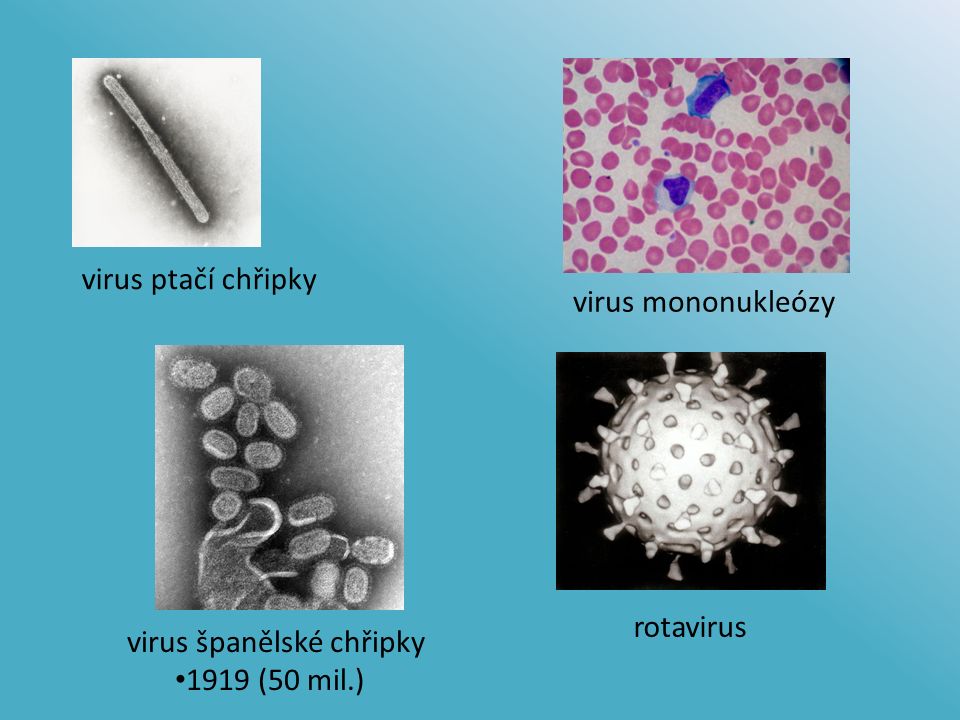 virus ptačí chřipky virus španělské chřipky 1919 (50 mil.) virus mononukleózy rotavirus