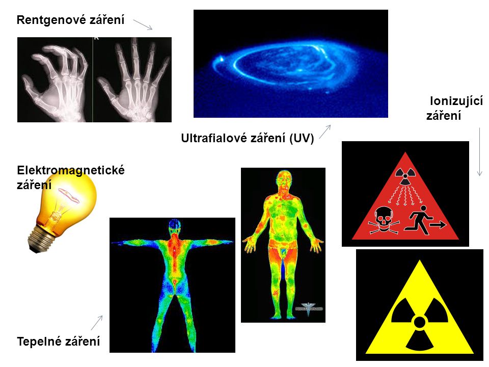 Elektromagnetické záření Ultrafialové záření (UV) Ionizující záření Tepelné záření Rentgenové záření