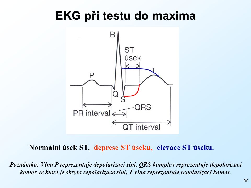 EKG při testu do maxima * Normální úsek ST, deprese ST úseku, elevace ST úseku.