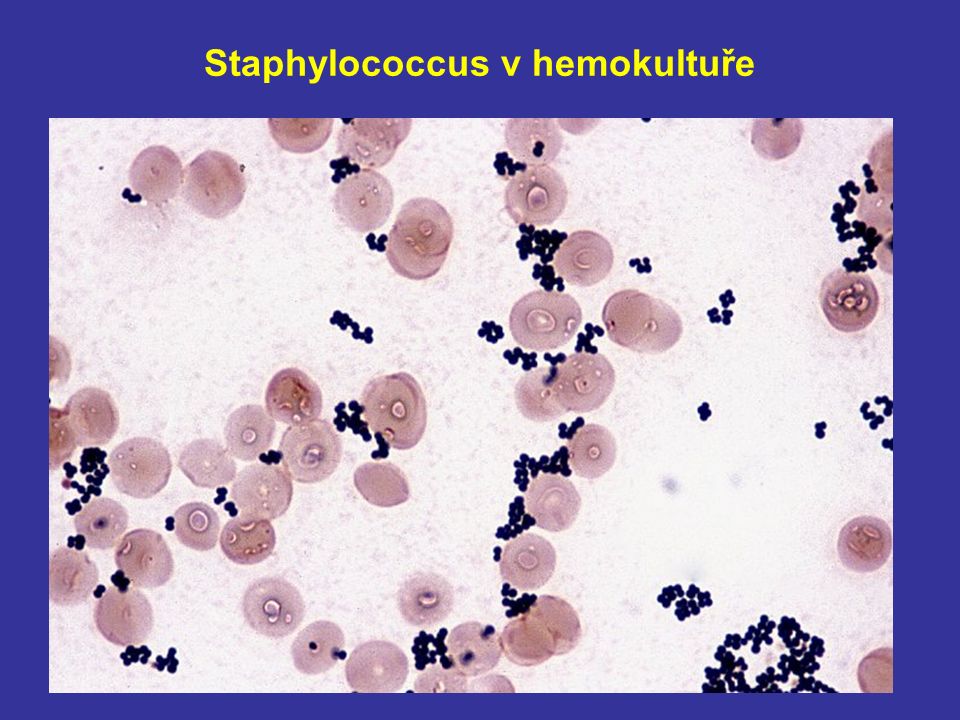 Staphylococcus aureus 3. Золотистый стафилококк эритроциты. Эритроцит стафилококк. Стафилококкус Пиогенезис.
