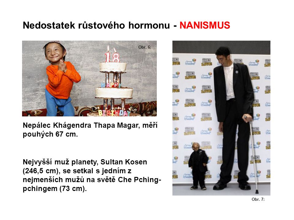 Nedostatek růstového hormonu - NANISMUS Nejvyšší muž planety, Sultan Kosen (246,5 cm), se setkal s jedním z nejmenších mužů na světě Che Pching- pchingem (73 cm).