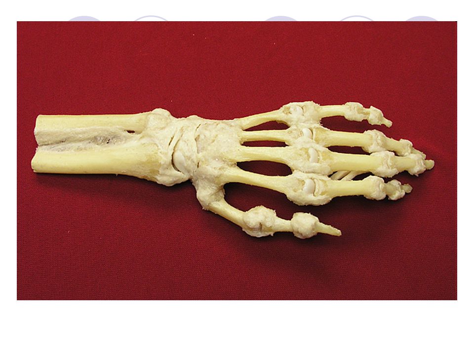 Скелет пальцев человека. Скелет кисти человека. Скелет руки. Человеческая рука кости. Человеческая кисть скелет.